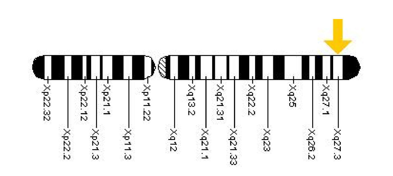 Fig. 1 Location of FMR1 on X chromosome 