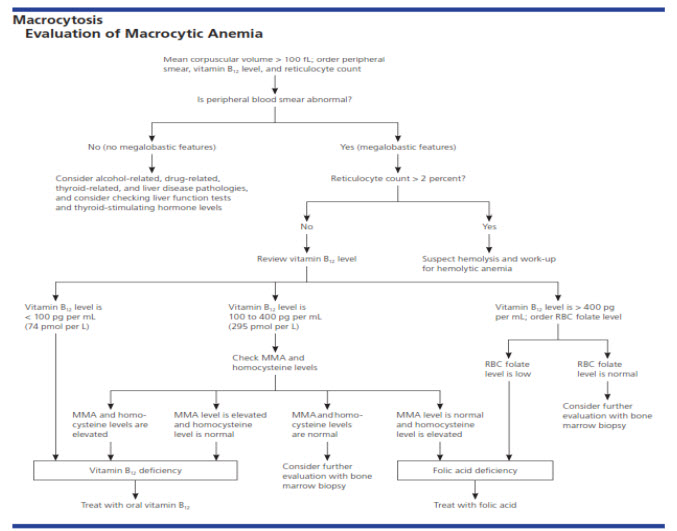 Marcocytosis Evaluation of Macrocytic Anemia